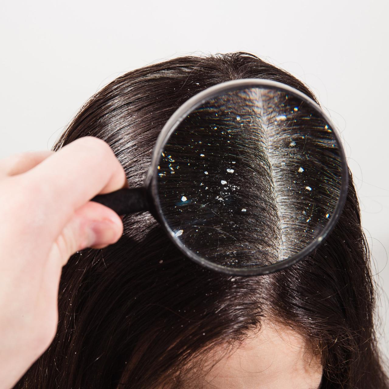 Rebalancing Your Scalp the Ayurvedic Way