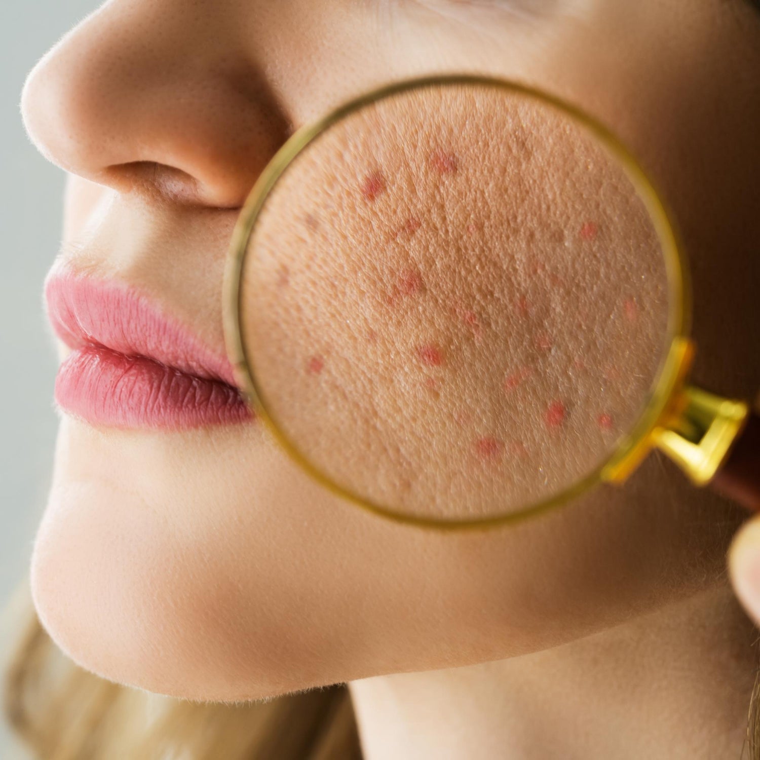 Step by step skincare routine for acne prone skin